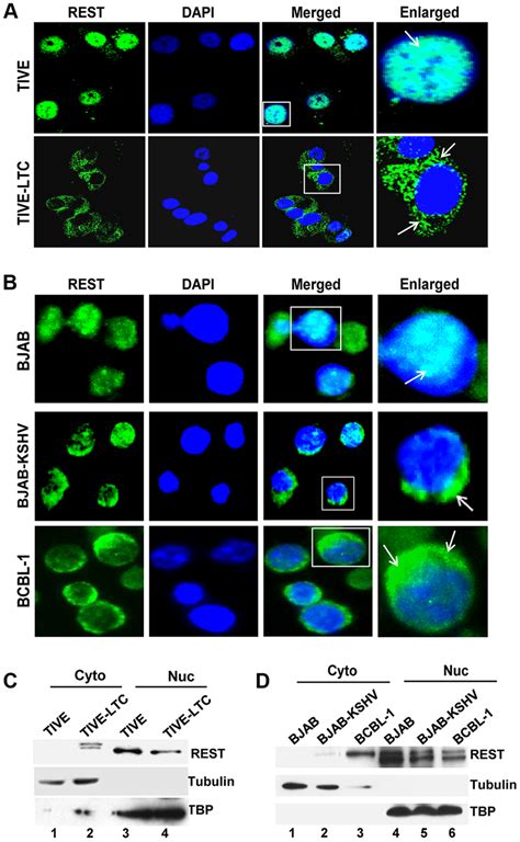 Cytoplasmic Localization Of Rest In Kshv Infected Cells A