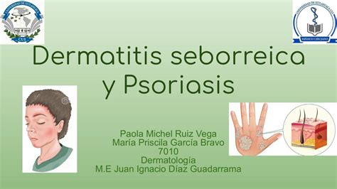 Dermatitis Seborreica Y Psoriasis Mich Vega Udocz