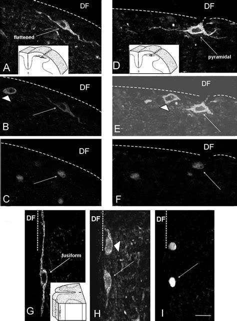 Imbalance Between The Expression Of Nk1 And Gabab Receptors In