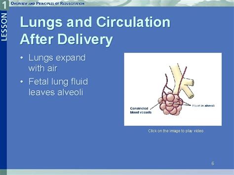 Lesson 1 Overview And Principles Of Resuscitation Neonatal