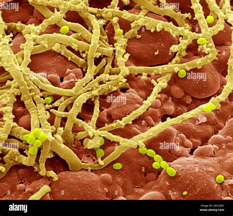 Bread Mould Coloured Scanning Electron Micrograph Sem Of Penicillium