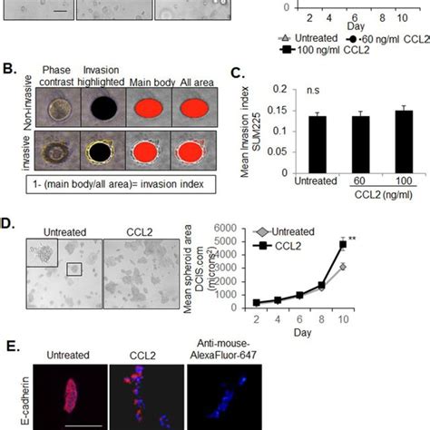 Figure S1 Effect Of CCR2 Overexpression On CCL2 Expression