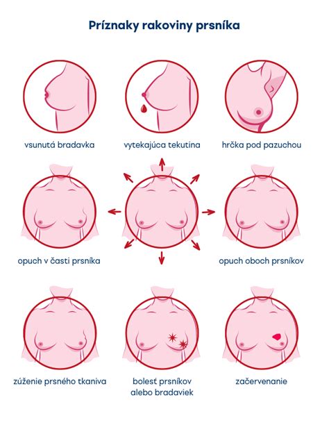 Karcinóm prsníka prejavy diagnostika liečba prevencia