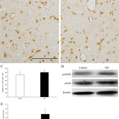 Vip Increases Protein Levels Of P Enos After Mcao A B The Expression Download Scientific