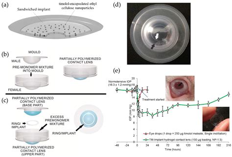 In Vitro And In Vivo Evaluation Of Novel Implantation