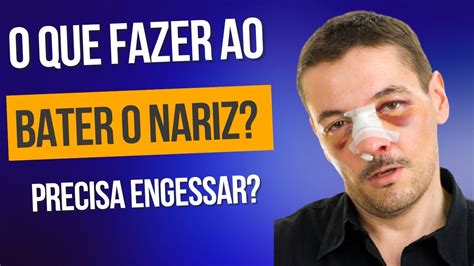 O Que Fazer Ao Bater O Nariz Trauma Nasal Ou Nariz Quebrado YouTube