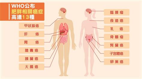 一張圖曝光肥胖恐怖的真相 這13種癌症竟會不知不覺纏你 健康 三立新聞網 Setncom