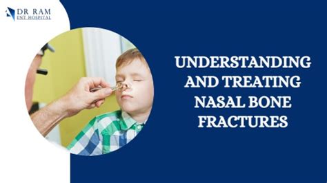 Fracture Nasal Bone Treatment