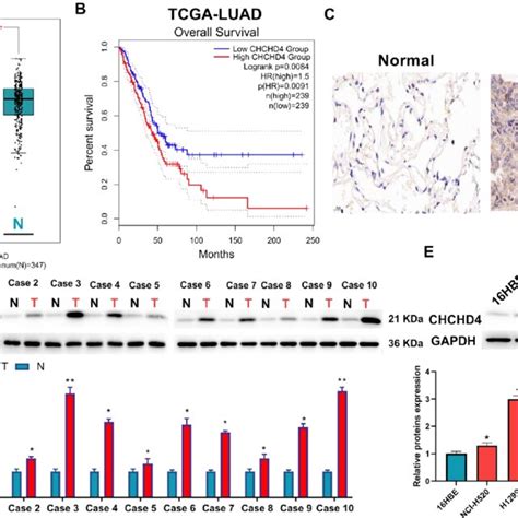 CHCHD4 Overexpression Was Found In LUAD Patients And Cells And Was