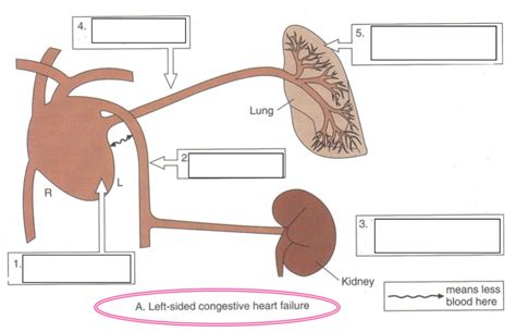 diagram  left sided congestive heart failure quizlet