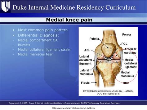 Ppt Knee Pain Powerpoint Presentation Free Download Id4778048