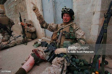 Shrapnel Wounds Photos and Premium High Res Pictures - Getty Images