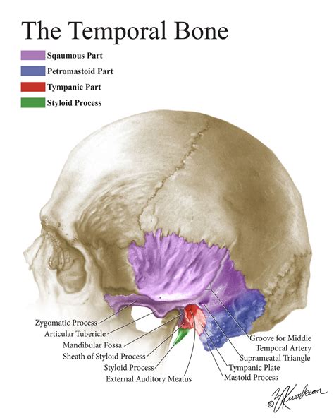 Tympanic Plate Fractures In Temporal Bone Trauma Prev