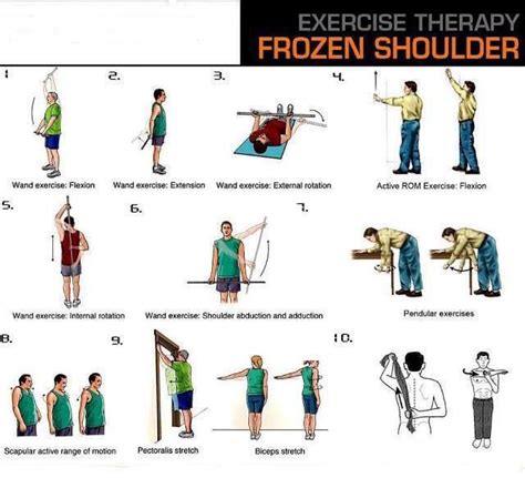 15 best Frozen Shoulder Exercises images on Pinterest | Frozen shoulder ...