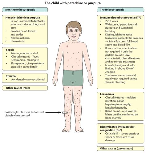 Petechiae Causes