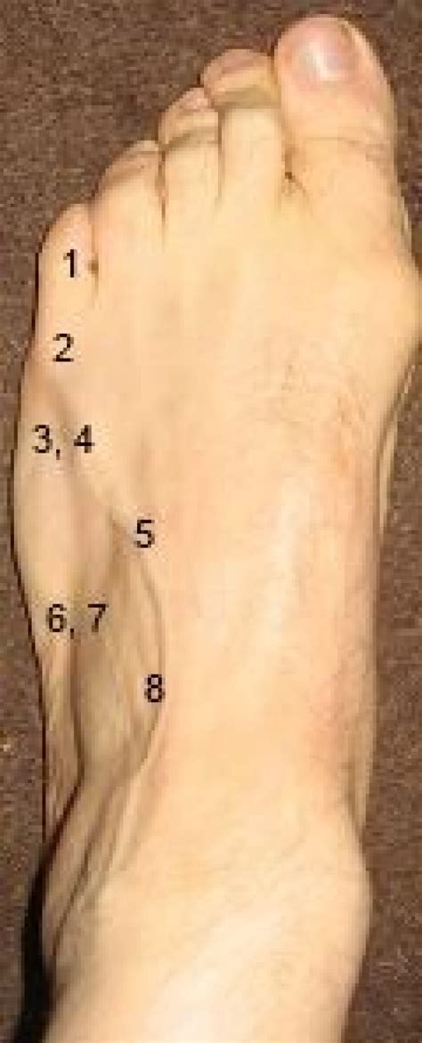 Types Of Foot Pain Diagram