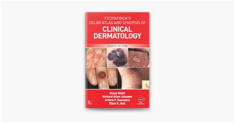 Fitzpatrick S Color Atlas And Synopsis Of Clinical Dermatology Eighth