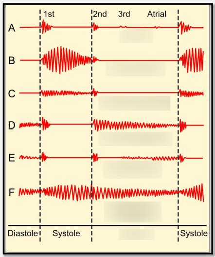 Types Of Murmurs Diagram Quizlet