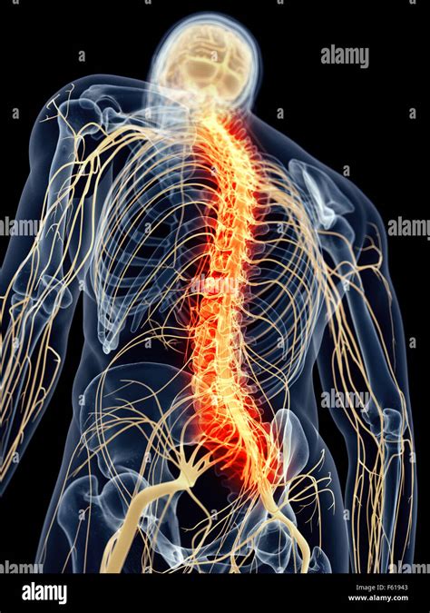 Medically Accurate Illustration Painful Spine Stock Photo Alamy