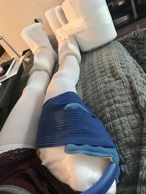 My Fai Journey Weeks Post Surgery Check In And Updates Jersey