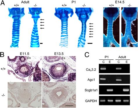 Cav T Type Calcium Channel Is Required For The Nfat Dependent Sox