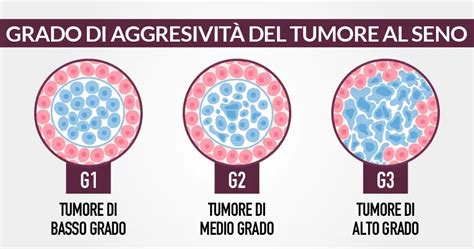 Grado Di Aggressivit Del Tumore Al Seno Tumore Seno