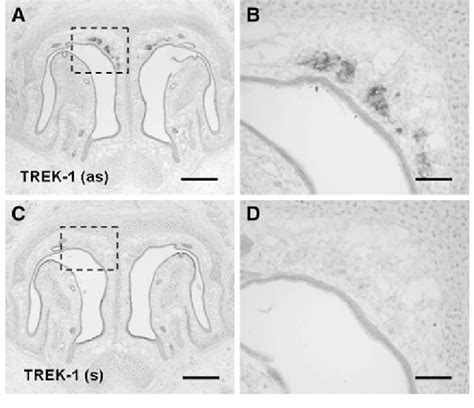 Expression of TREK-1 mRNA in the GG. a TREK-1 expression in the GG was ...