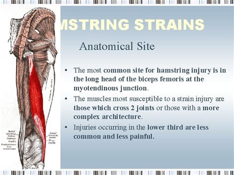 Hamstring Strains Possible Cause And Risk Factors Biomechanics