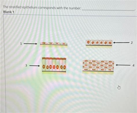 Solved The stratified epithelium corresponds with the | Chegg.com