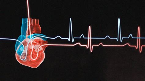 Cardiac Muscle Tissue Definition Function And Structure