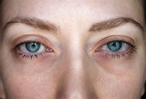 How diabetes can affect the eyes