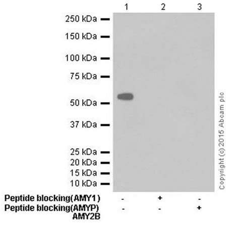 Anti Salivary alpha amylase 抗体 EPR18070 BSA and Azide free ab251506