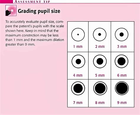 Pupil Size Chart Printable | Portal.posgradount.edu.pe