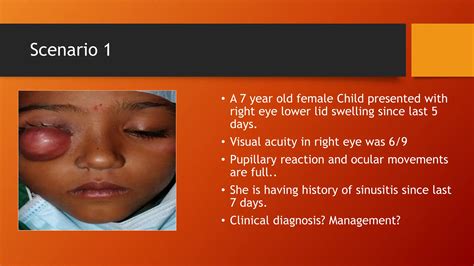 Case Based Scenarios Orbit Orbital Cellulitis Ppt