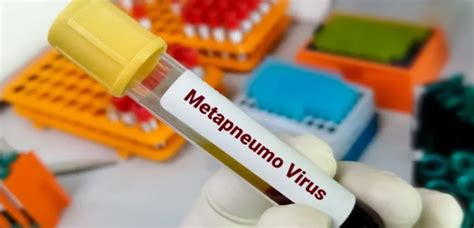 Metapneumovirus todo lo que debes conocer sobre esta infección