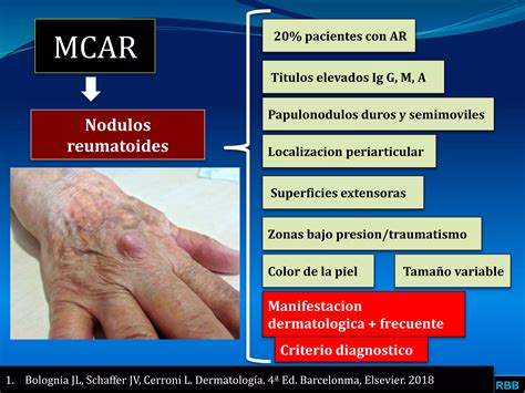 Manifestaciones Cutaneas De Artritis Reumatoidea Ppt