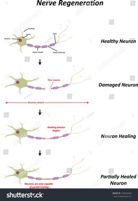 Nerve Regeneration Healing Ez Canvas