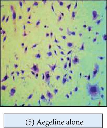 Oil Red O Lipid Staining In IC 21 Cells Treated With Ox LDL And The