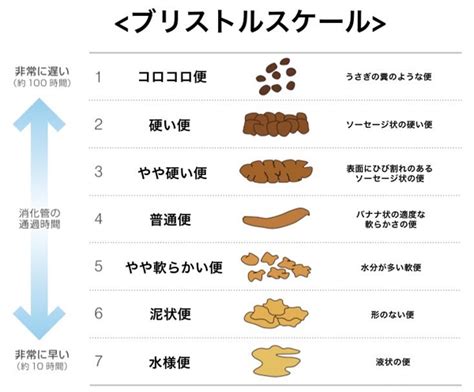 大腸がんの原因・症状・検査・治療池袋駅徒歩1分の消化器科