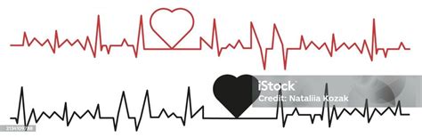 Palpitation Cardiogram Design Elements Set Cardiograms Of A Healthy