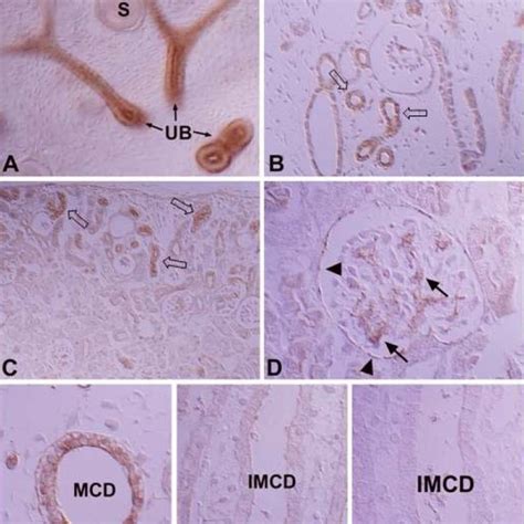 Dic Micrographs Of Wax Sections Illustrating Immunostaining For Protein