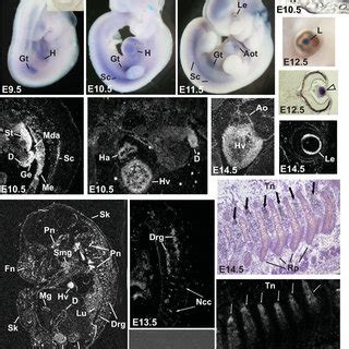 Gene Expression Of Xenopus Ened Whole Mount In Situ Hybridization With