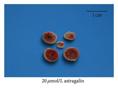 Effect of astragalin on I/R-induced IS. (a–e) Representative ...