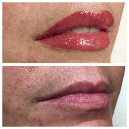 Permanent Makeup Lips Before After Bios Pics