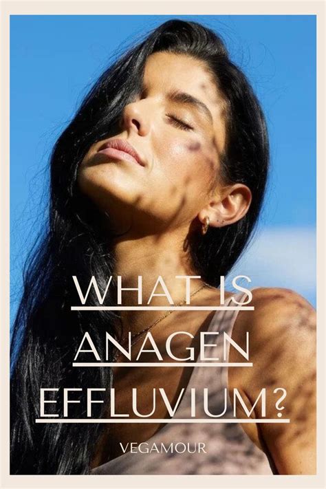 What Is Anagen Effluvium? Causes, Treatments and More in 2021 | Anagen ...