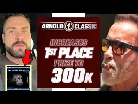 Cbum Torn Biceps Arnold Classic Prize Money Increased Nick Walker