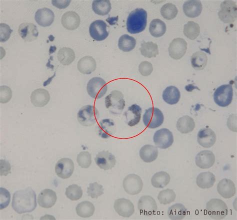 Sophisticated Family Planning In Malaria Parasites | Science Trends