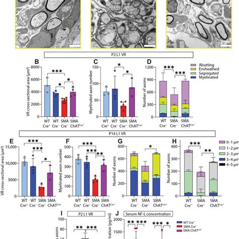 Selective Restoration Of Smn In Motor Neurons Restores Motor Axon