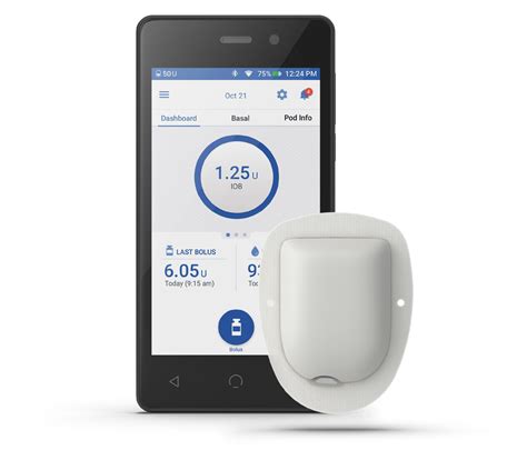 Il Sistema Omnipod Dash Un Microinfusore Per Insulina Impermeabile E