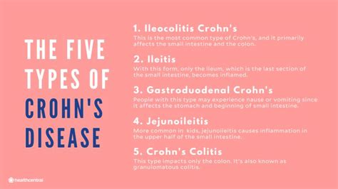 Crohns Disease Symptoms Causes Treatments And More Crohns Disease